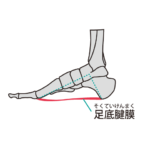 足底腱膜のイラスト