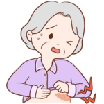 帯状疱疹の女性のイラスト