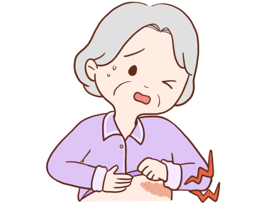 帯状疱疹の女性のイラスト