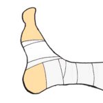足首の怪我のイラスト